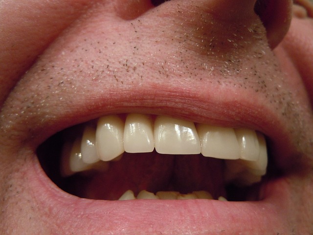 dental crowns photo